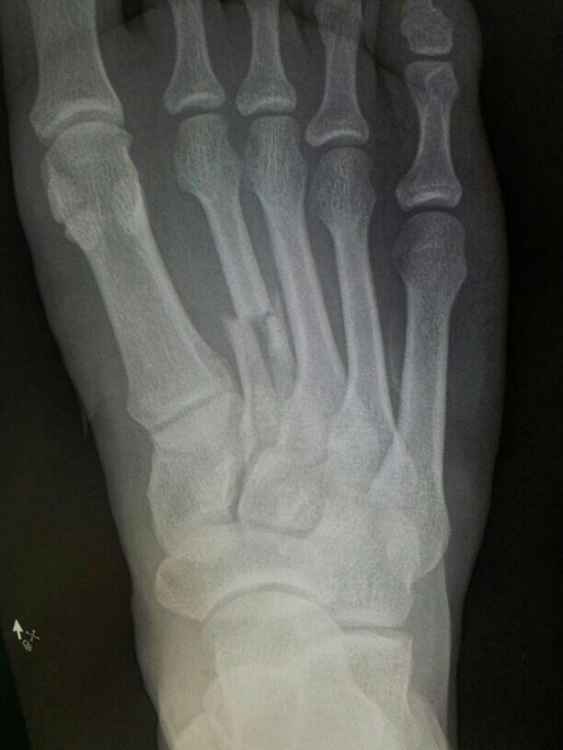 post-115694-1355840398_thumb.jpg